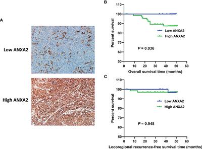 Knockdown of <mark class="highlighted">Annexin A2</mark> Enhances Radiosensitivity by Increasing G2/M-Phase Arrest, Apoptosis and Activating the p38 MAPK-HSP27 Pathway in Nasopharyngeal Carcinoma